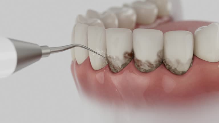 Trusted Dental Implants service in Keego Harbor, MI - Dentist Open Now